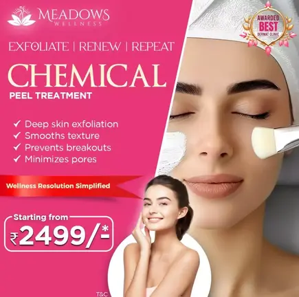 Chemical Peels at just 2499/-